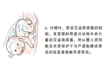 2024预防艾滋病工作总结最新8篇